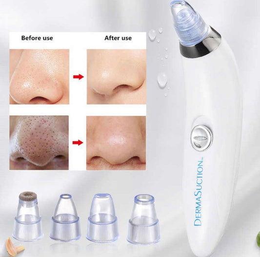 Blackhead Removal Machine