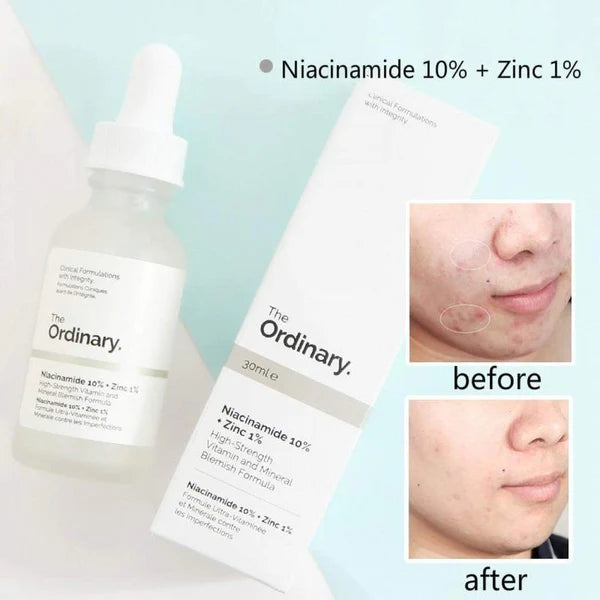 Ordinary Niacinamide 10% + Zinc 1%  (Buy1 Get 1 Free)